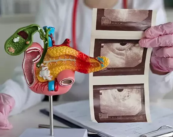 Ärztin mit einem Modell der Bauchspeicheldrüse und sie hält Ultraschallaufnahmen eines Pankreas daneben.