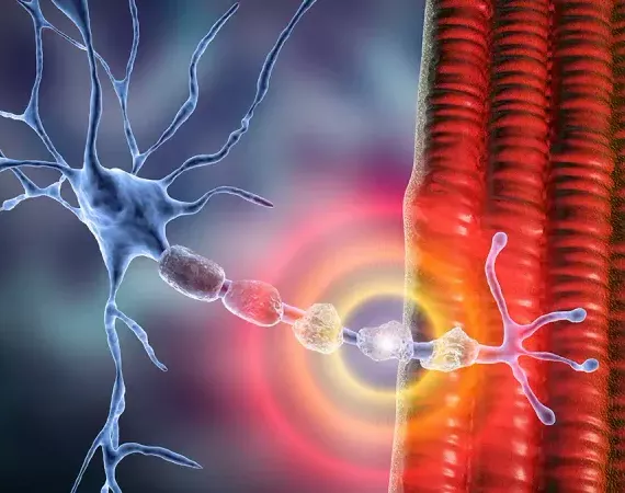 Darstellung von Demyelinisierung